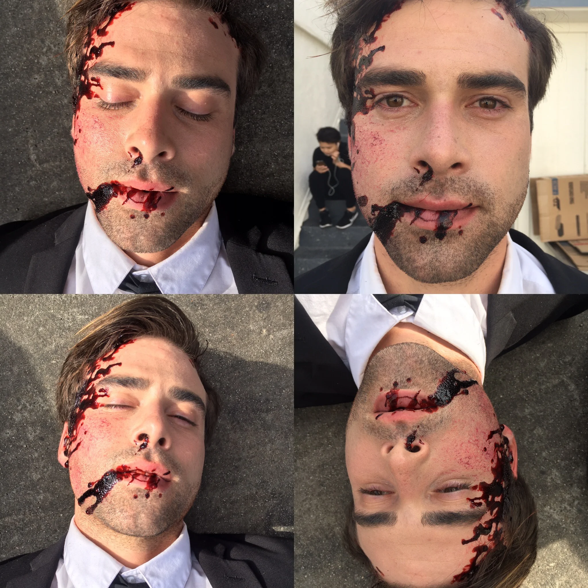 blood &amp; abrasions