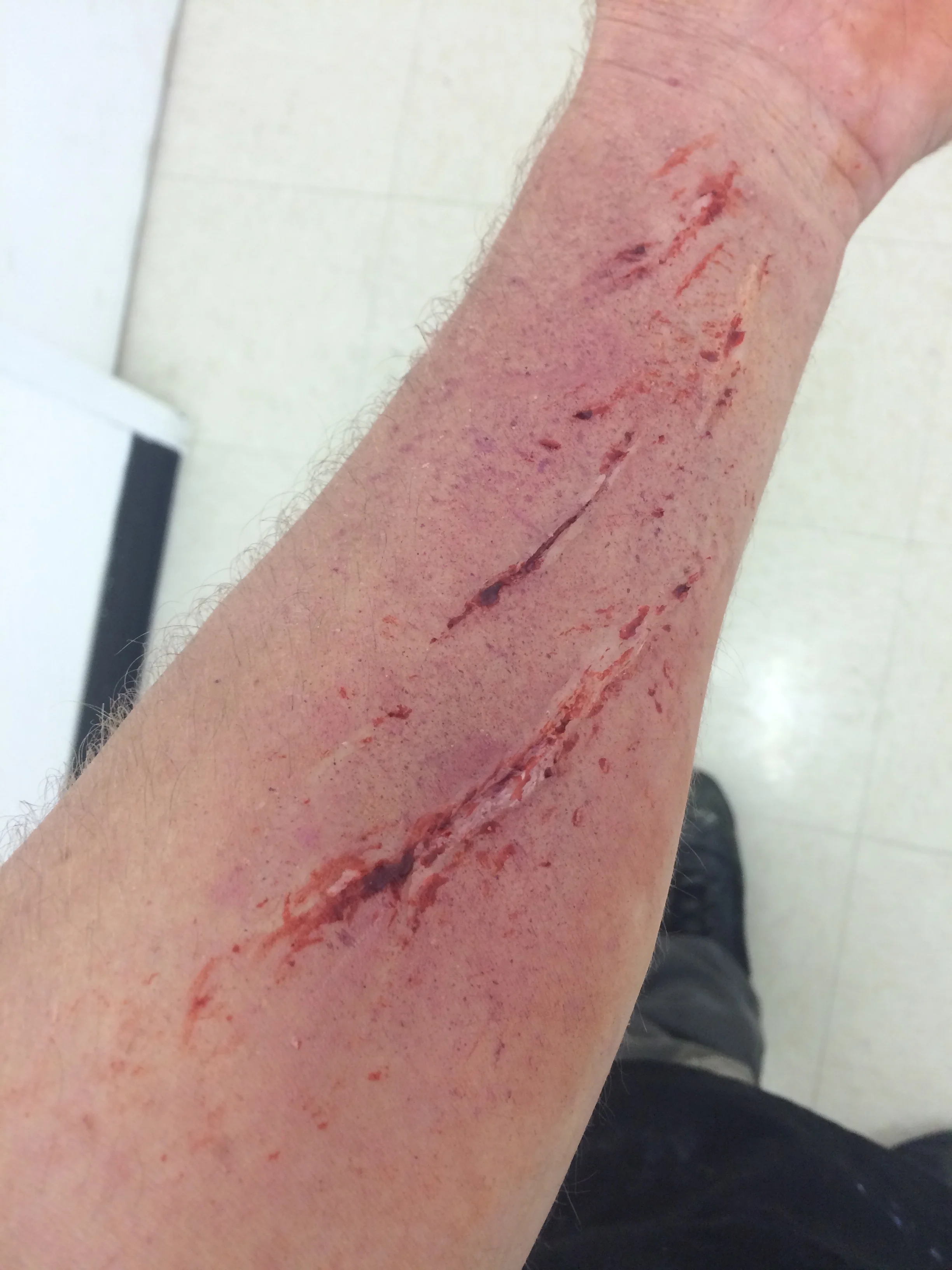slashes