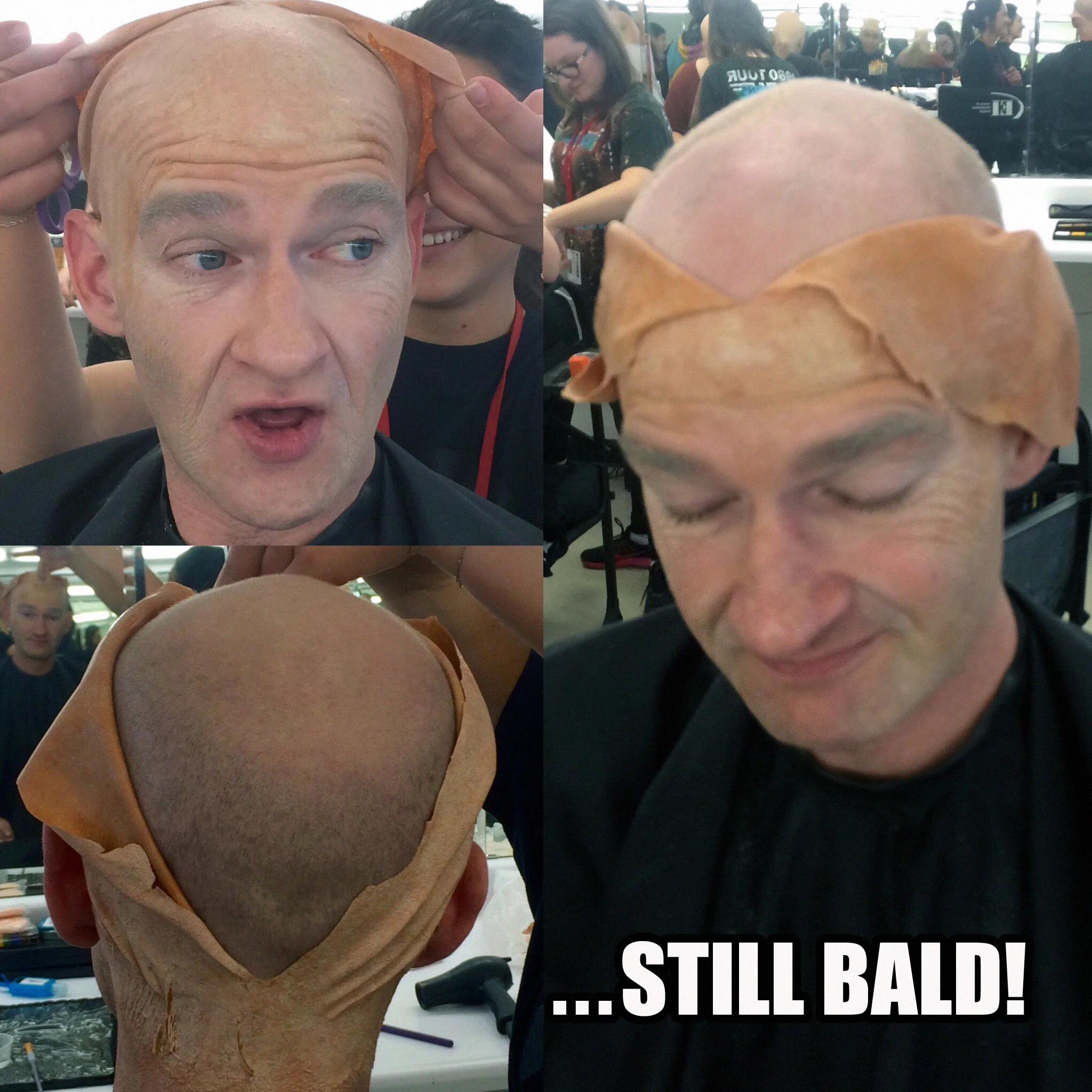 5 still bald.jpg